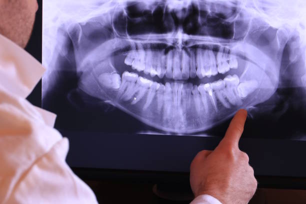 Best Emergency Root Canal Treatment in Old Town, ME